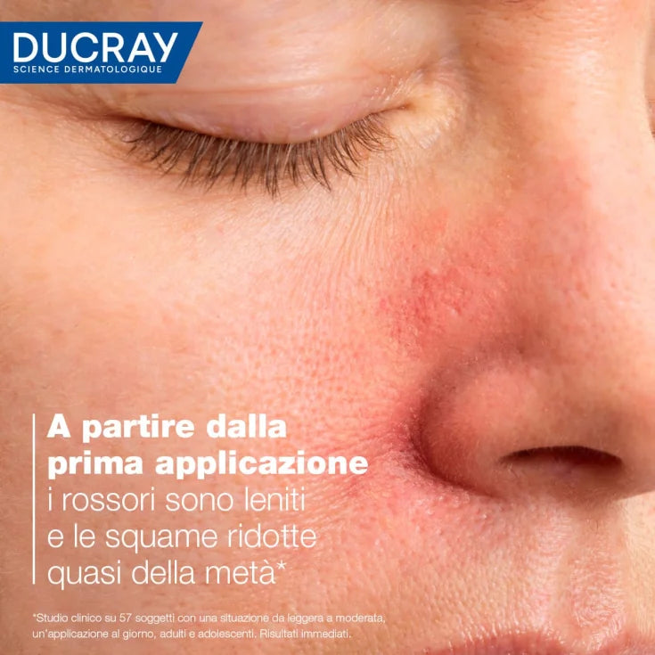 DUCRAY KELUAL DS CREMA LENITIVA 40ML - Anti-squame viso