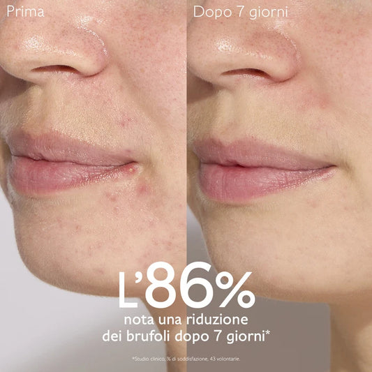 CAUDALIE VINOPURE SIERO ACIDO SALICILICO ANTI-IMPERFEZIONE